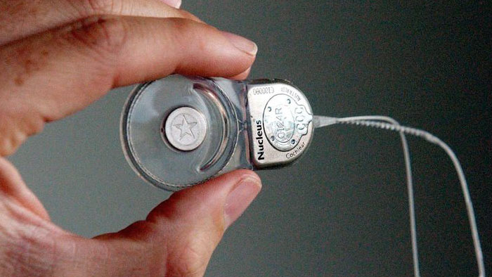 Cochlear Implant